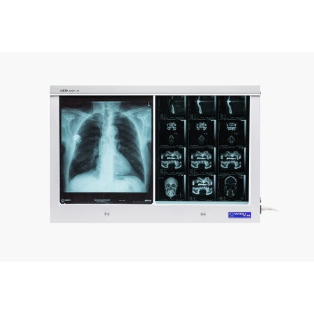 Negatoskop LED NGP 21